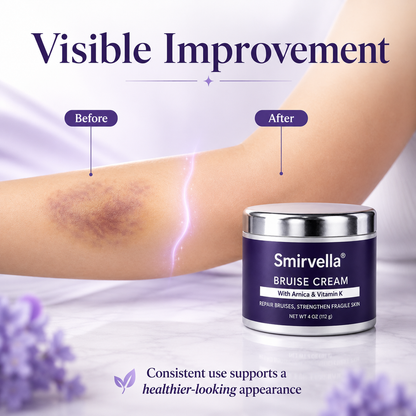 Bruise Cream
